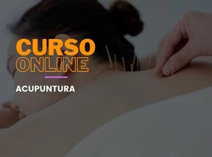 Acupuntura Acupuntura