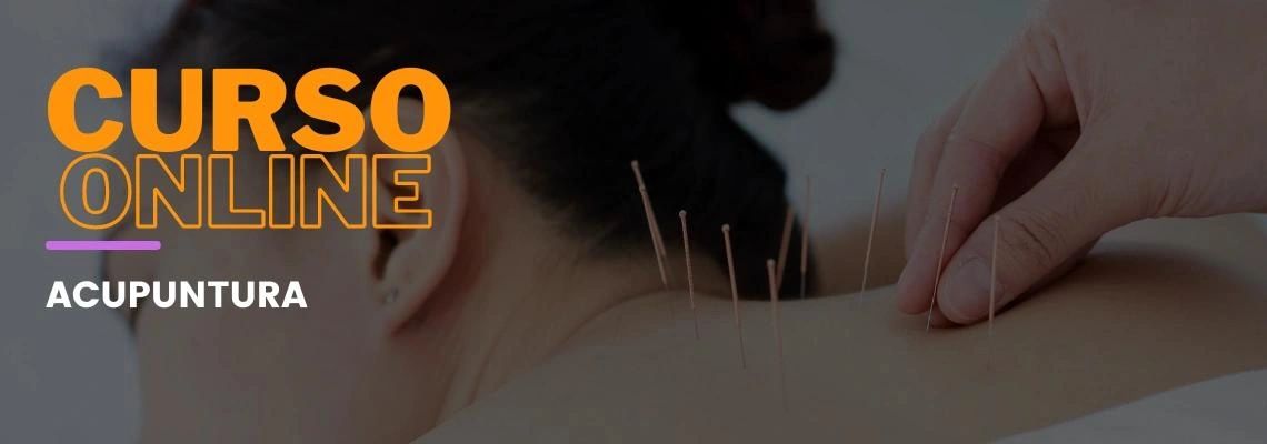 Acupuntura Acupuntura
